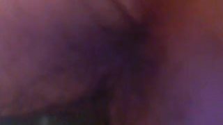 CLOSE UP Endoscope Asshole Hairy MILF Mature