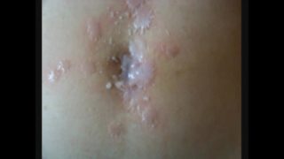 torturing my stepsister's belly with hot wax and massaging the navel