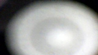 My sperm viewed in microscope