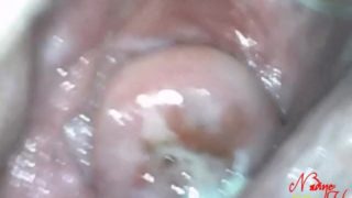 Deep Speculum Views of Gothic Uterus by Nadine Cays ! Deep Doctor Plays