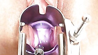 Radka Examination Video/Radka. Part 2