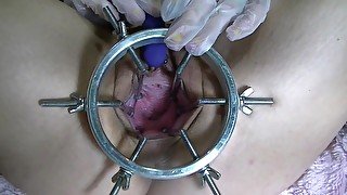 Open my pussy with ring spreader and orgasm