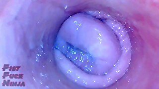 Pussy endoscope of Japanese milf AGAIN!!