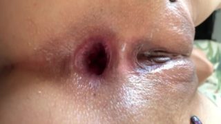 Asian anal gape close up