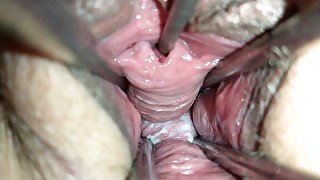 Pussy spreader 👀 fucking peehole with chopsticks 